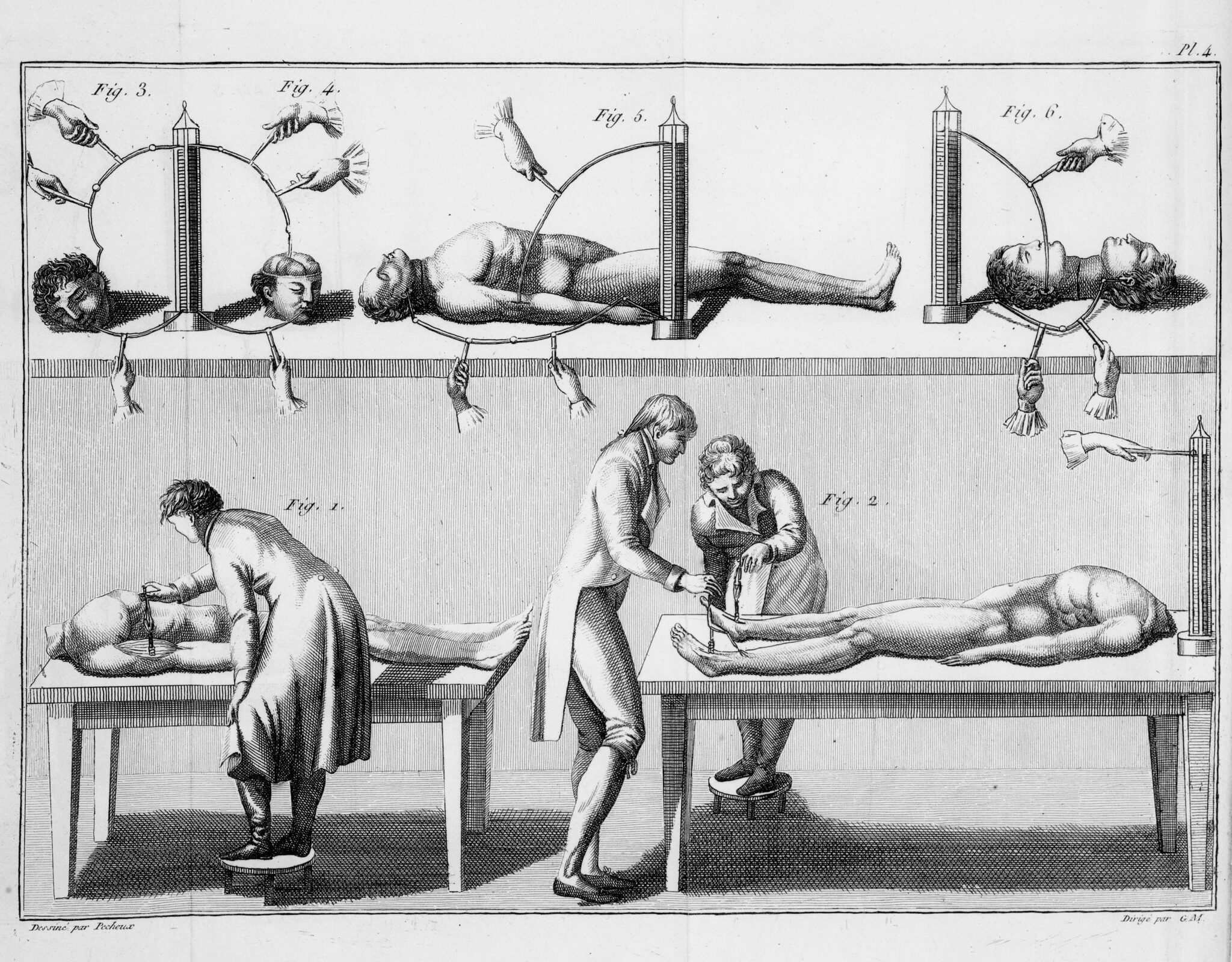 The gruesome, real-life experiments that inspired Frankenstein and their  scientific possibility | The Daily Nexus